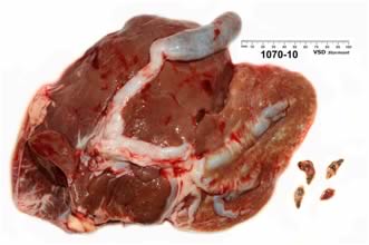Chronic liver fluke disease in a ewe, the damage to this liver is irreversible and could cause metabolic disease problems in subsequent pregnancies.